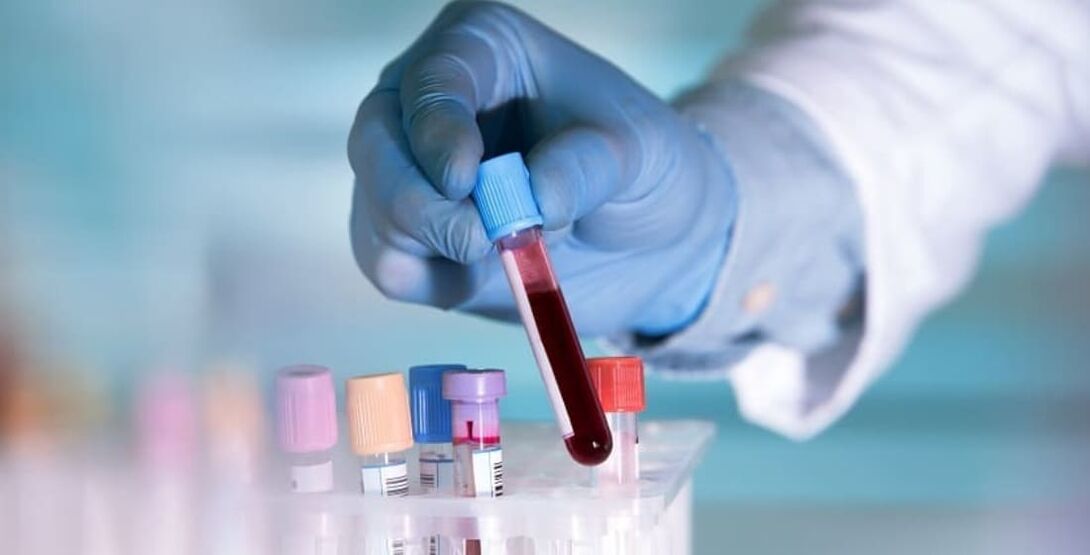 how alcohol affects the blood test